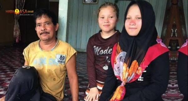 Unik, Ada Desa Terpencil di Aceh, Warganya Lahirkan Generasi Bule Bermata Biru