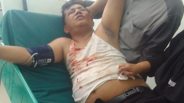 Kepala Desa di Bekasi Luka Parah di Kepala karena Tertimpa Baliho Caleg